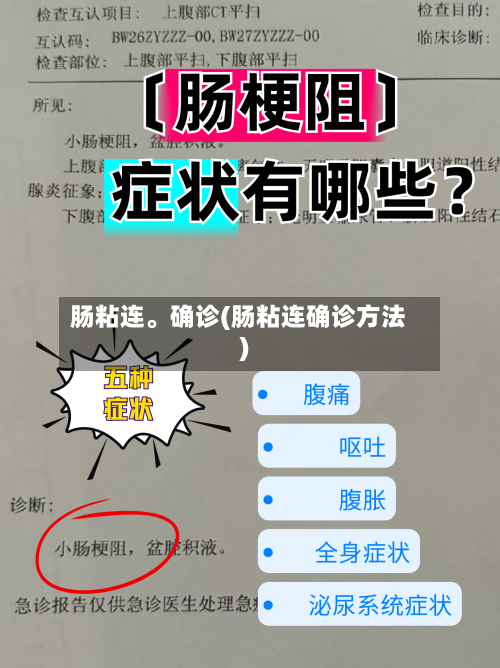 肠粘连	。确诊(肠粘连确诊方法)-第3张图片