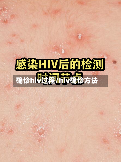 确诊hiv过程/hiv确诊方法