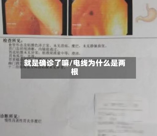 就是确诊了嘛/电线为什么是两根-第3张图片