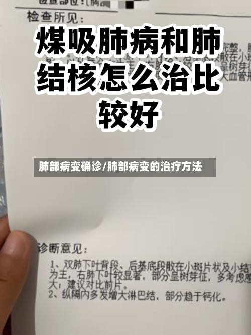 肺部病变确诊/肺部病变的治疗方法-第2张图片