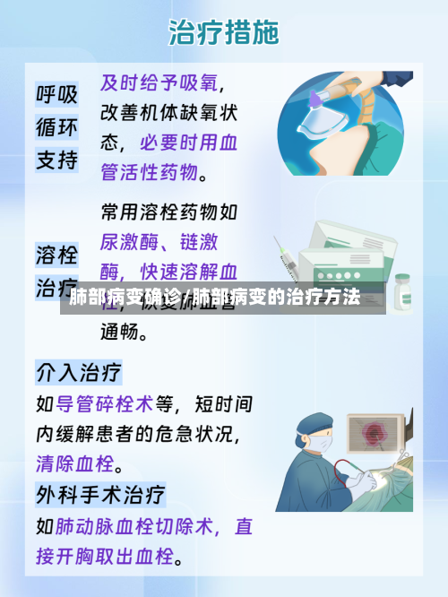 肺部病变确诊/肺部病变的治疗方法-第3张图片