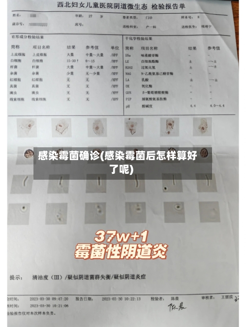 感染霉菌确诊(感染霉菌后怎样算好了呢)