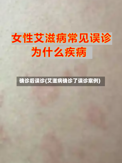 确诊后误诊(艾滋病确诊了误诊案例)-第3张图片