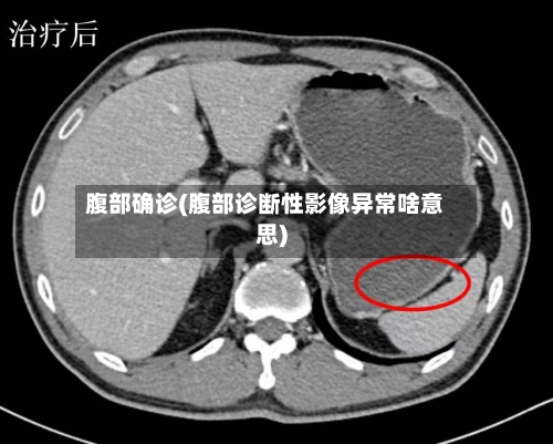 腹部确诊(腹部诊断性影像异常啥意思)