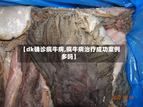 【dk确诊疯牛病,疯牛病治疗成功案例多吗】-第2张图片