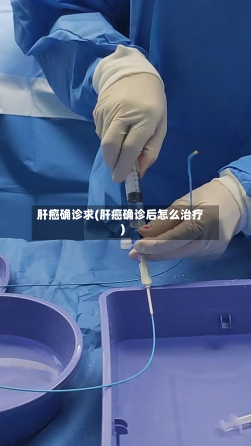 肝癌确诊求(肝癌确诊后怎么治疗)