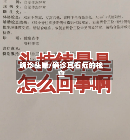 确诊头晕/确诊耳石症的检查-第3张图片
