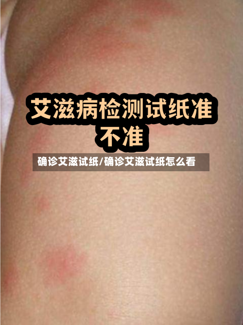 确诊艾滋试纸/确诊艾滋试纸怎么看