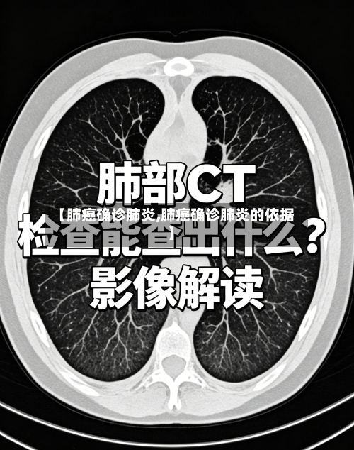 【肺癌确诊肺炎,肺癌确诊肺炎的依据】